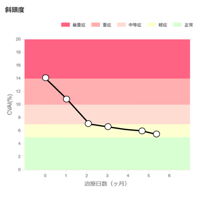斜頭度（左右非対称の形）のイメージ