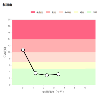 斜頭度（左右非対称の形）のイメージ