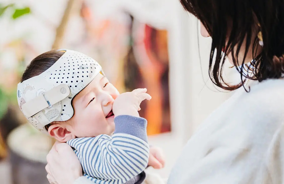 頭の形外来イメージ